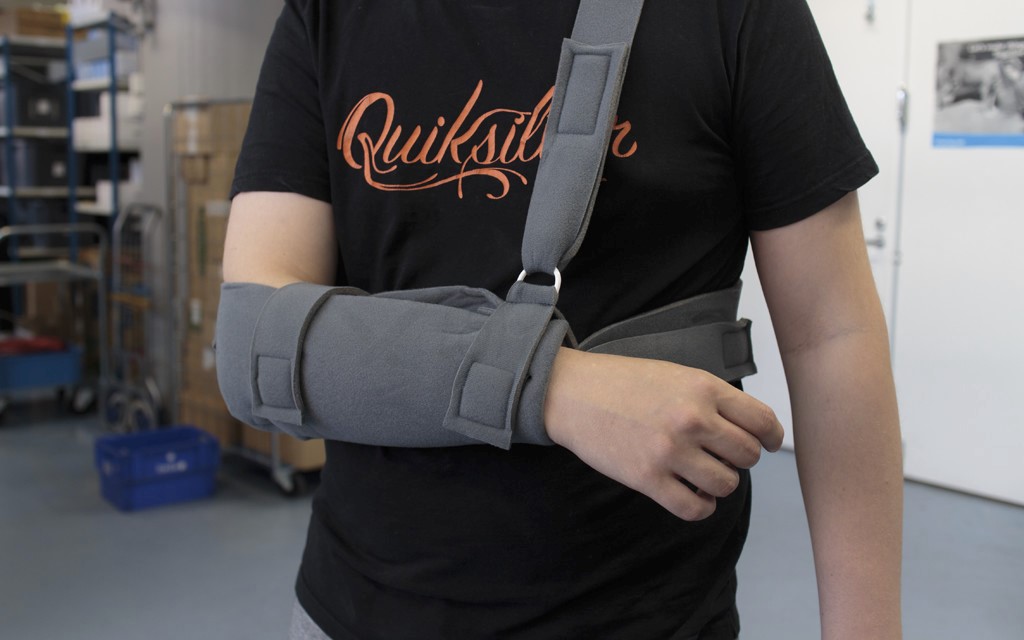 hanging arm cast for humerus fracture